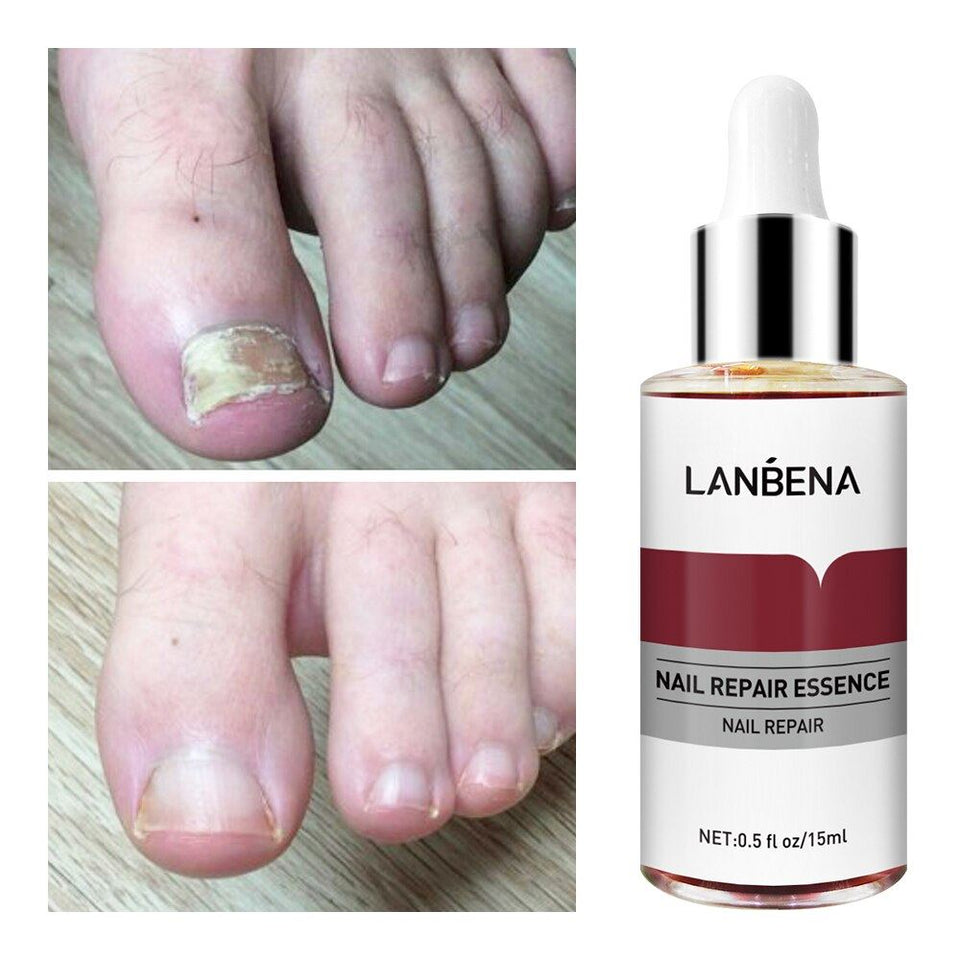 Serum lanbena Anti Hongos