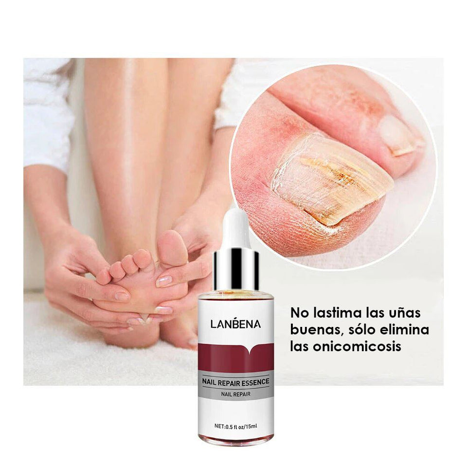 Serum lanbena Anti Hongos