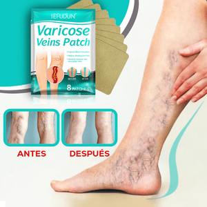 Parche Naturales de Varices
